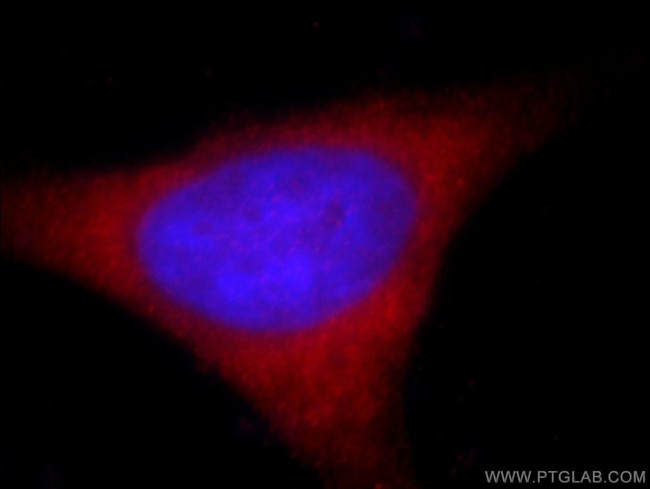 KIFC1 Antibody in Immunocytochemistry (ICC/IF)