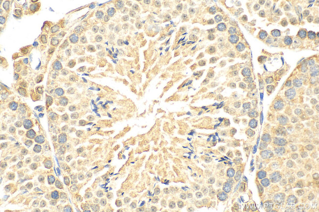 GPR172B Antibody in Immunohistochemistry (Paraffin) (IHC (P))