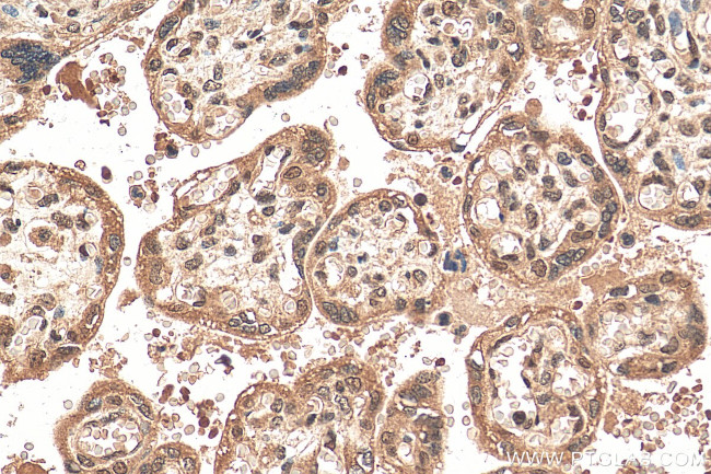 ZNF346 Antibody in Immunohistochemistry (Paraffin) (IHC (P))