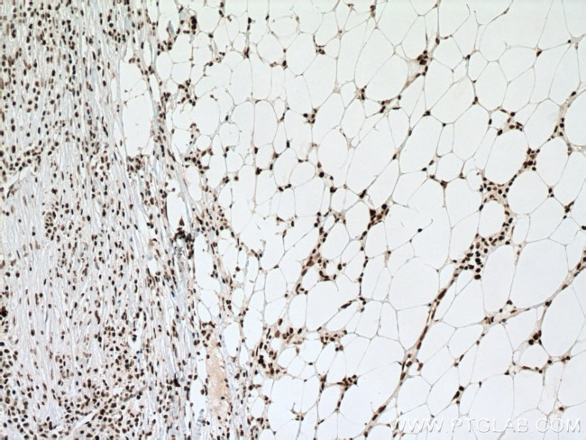NUP50 Antibody in Immunohistochemistry (Paraffin) (IHC (P))