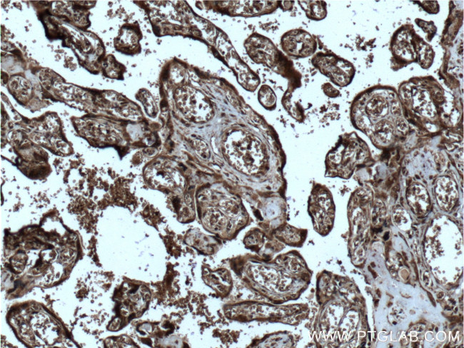 SPRYD5 Antibody in Immunohistochemistry (Paraffin) (IHC (P))
