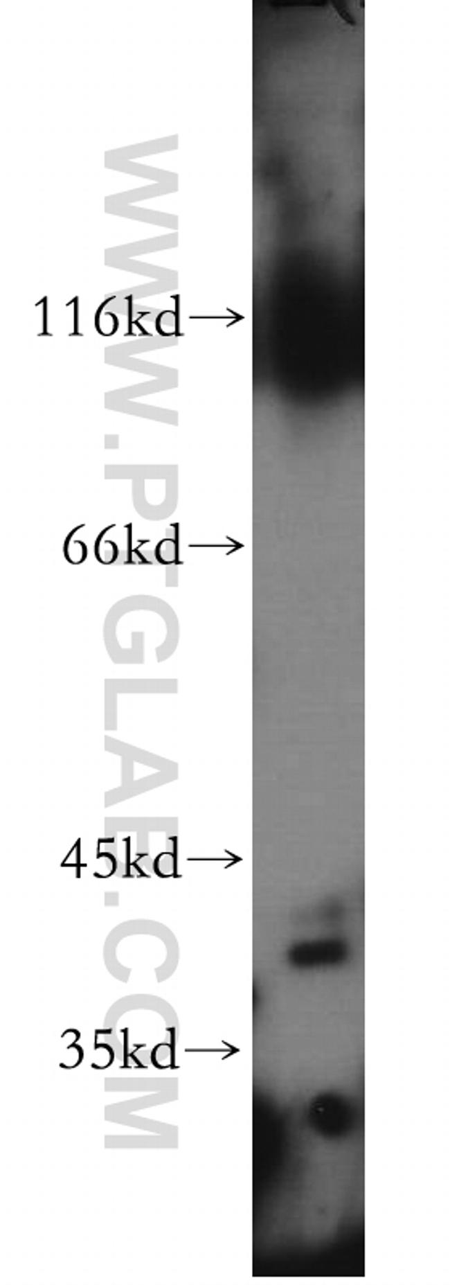 ZNF385D Antibody in Western Blot (WB)