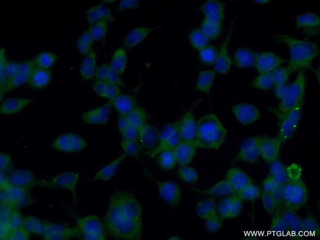 SHD Antibody in Immunocytochemistry (ICC/IF)