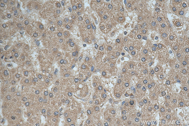 GALNT10 Antibody in Immunohistochemistry (Paraffin) (IHC (P))