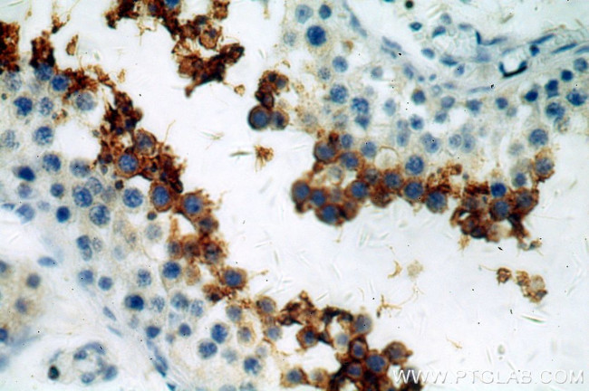GLIPR1L1 Antibody in Immunohistochemistry (Paraffin) (IHC (P))