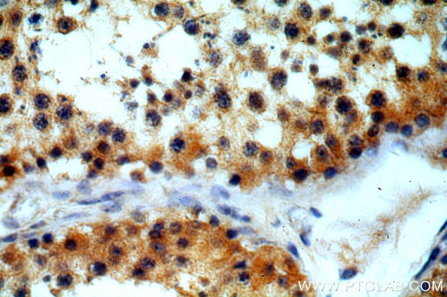 CCDC42 Antibody in Immunohistochemistry (Paraffin) (IHC (P))