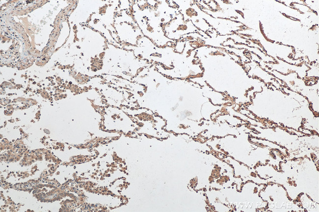 CXorf22 Antibody in Immunohistochemistry (Paraffin) (IHC (P))