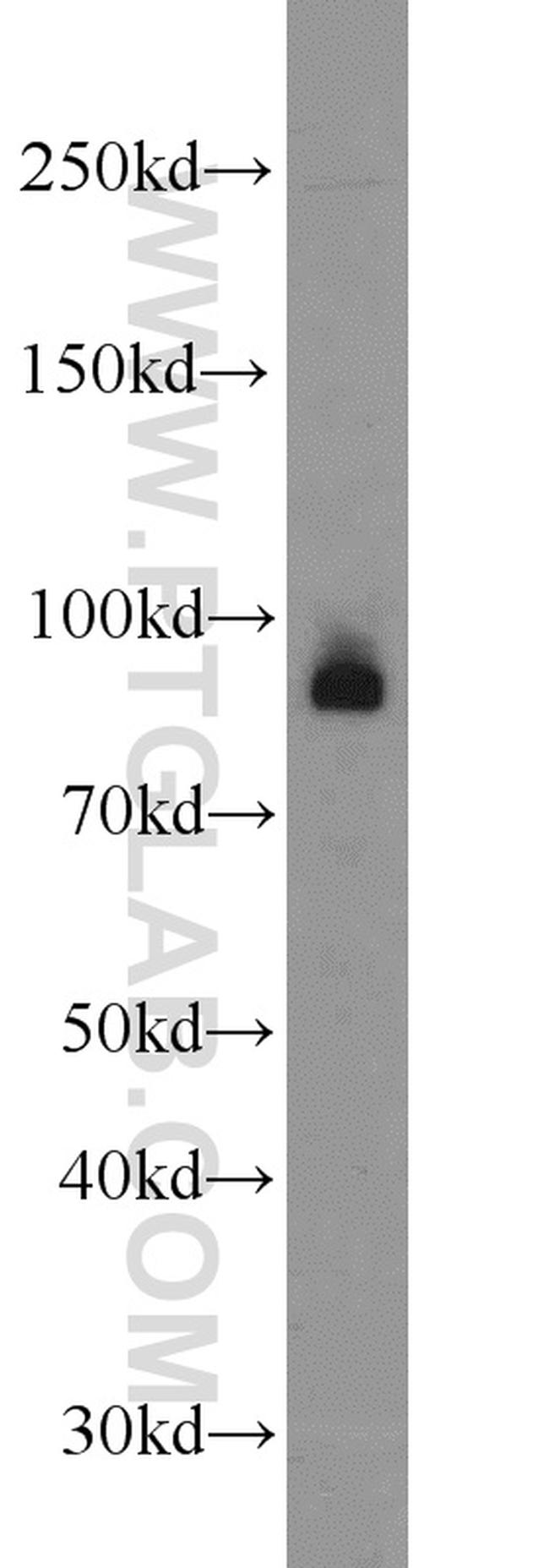 EZH1 Antibody in Western Blot (WB)