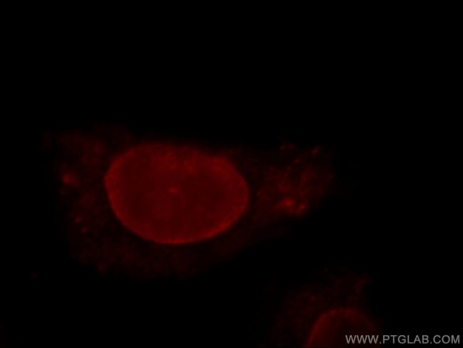 THAP2 Antibody in Immunocytochemistry (ICC/IF)