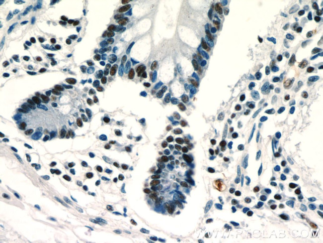 ZSCAN20 Antibody in Immunohistochemistry (Paraffin) (IHC (P))
