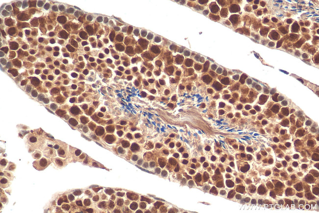 TCERG1L Antibody in Immunohistochemistry (Paraffin) (IHC (P))