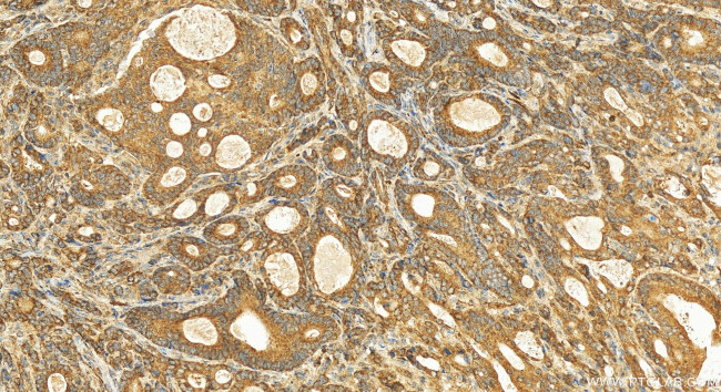 MICU2 Antibody in Immunohistochemistry (Paraffin) (IHC (P))