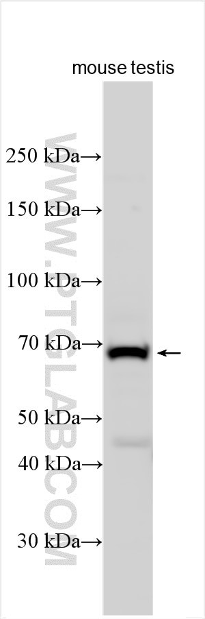 ZCWPW1 Antibody in Western Blot (WB)