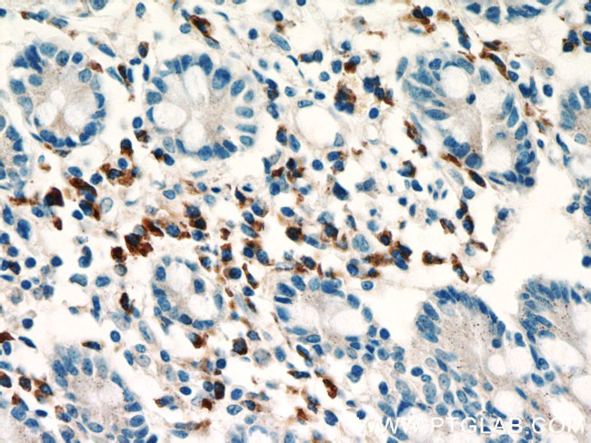SDF2L1 Antibody in Immunohistochemistry (Paraffin) (IHC (P))