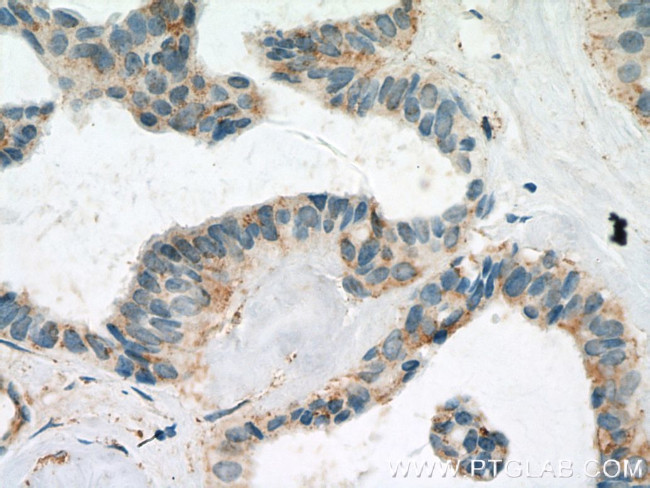 FBXL15 Antibody in Immunohistochemistry (Paraffin) (IHC (P))