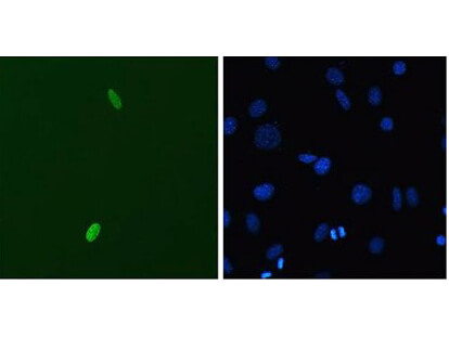 DUX4 Antibody in Immunocytochemistry (ICC/IF)