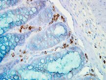 HSP90 alpha Antibody in Immunohistochemistry (Paraffin) (IHC (P))