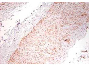 TNF alpha Antibody in Immunohistochemistry (Paraffin) (IHC (P))