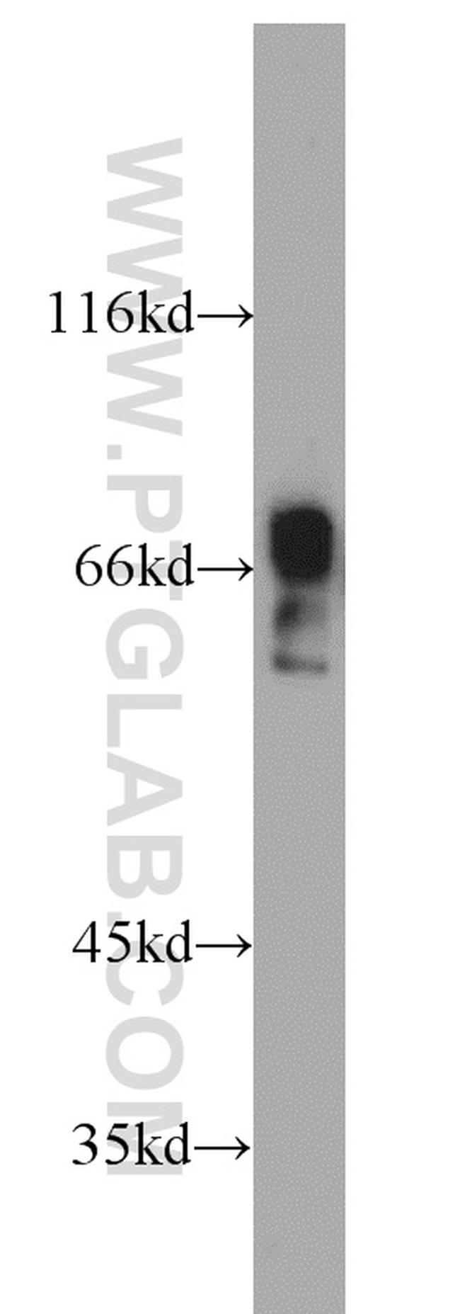 ZNF496 Antibody in Western Blot (WB)