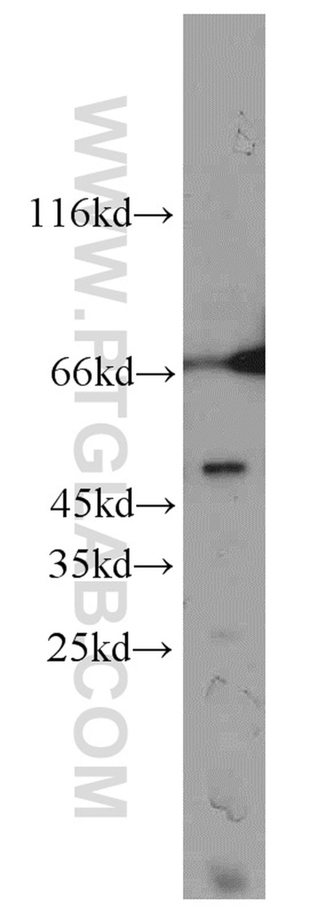 CCDC83 Antibody in Western Blot (WB)