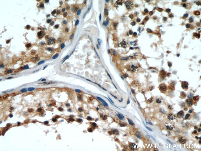 FAM71E2 Antibody in Immunohistochemistry (Paraffin) (IHC (P))