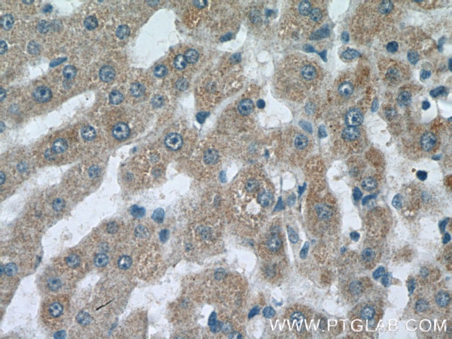 C3orf20 Antibody in Immunohistochemistry (Paraffin) (IHC (P))