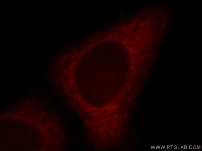 FGD5 Antibody in Immunocytochemistry (ICC/IF)