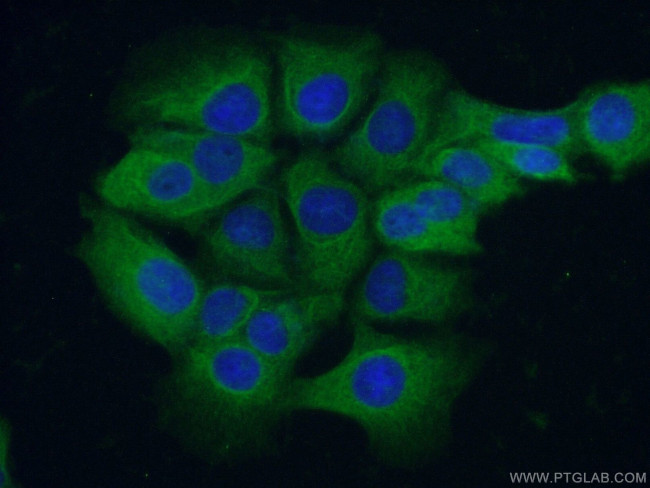 C11orf42 Antibody in Immunocytochemistry (ICC/IF)