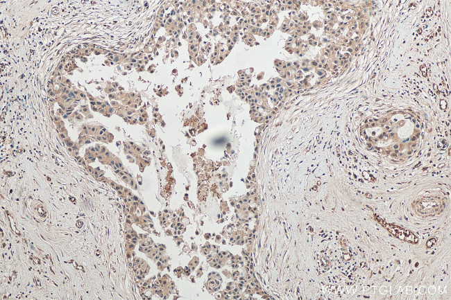 ITCH Antibody in Immunohistochemistry (Paraffin) (IHC (P))