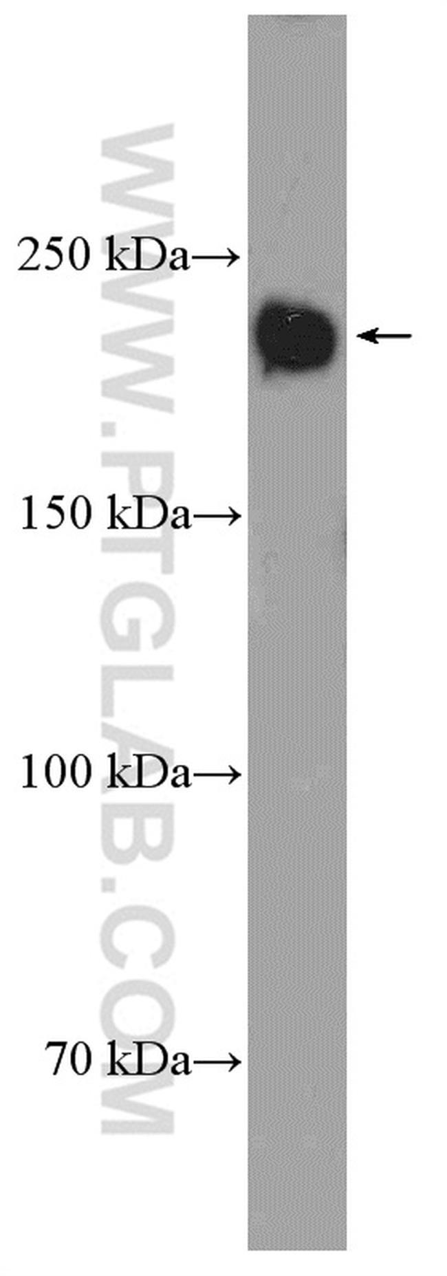 LAMC1 Antibody in Western Blot (WB)