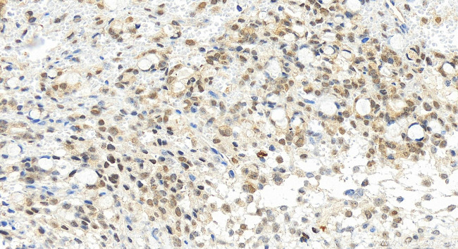 ZNF511 Antibody in Immunohistochemistry (Paraffin) (IHC (P))