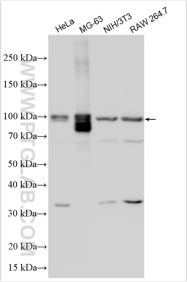 KLHDC8B Antibody in Western Blot (WB)