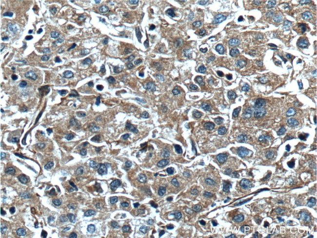 F5 Antibody in Immunohistochemistry (Paraffin) (IHC (P))