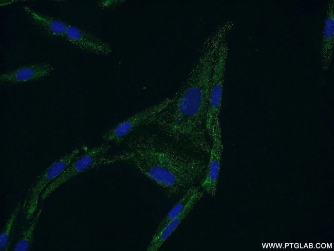 CYP11B2 Antibody in Immunocytochemistry (ICC/IF)