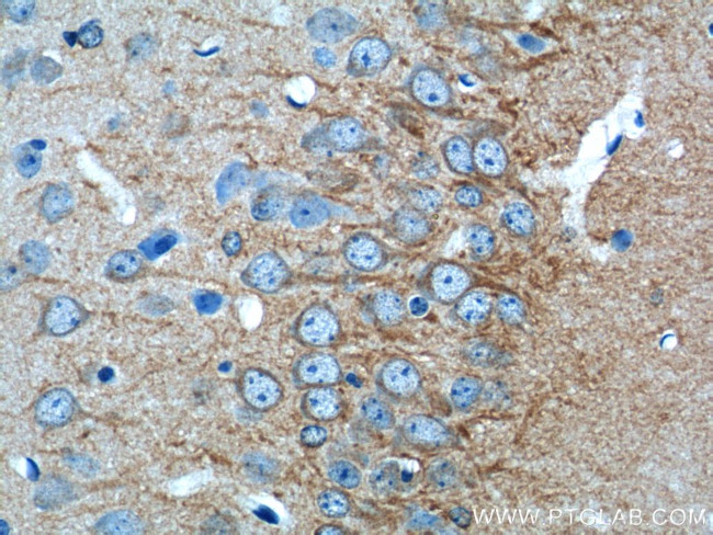 CACNG2 Antibody in Immunohistochemistry (Paraffin) (IHC (P))