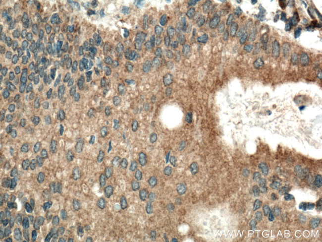 CAPN8 Antibody in Immunohistochemistry (Paraffin) (IHC (P))