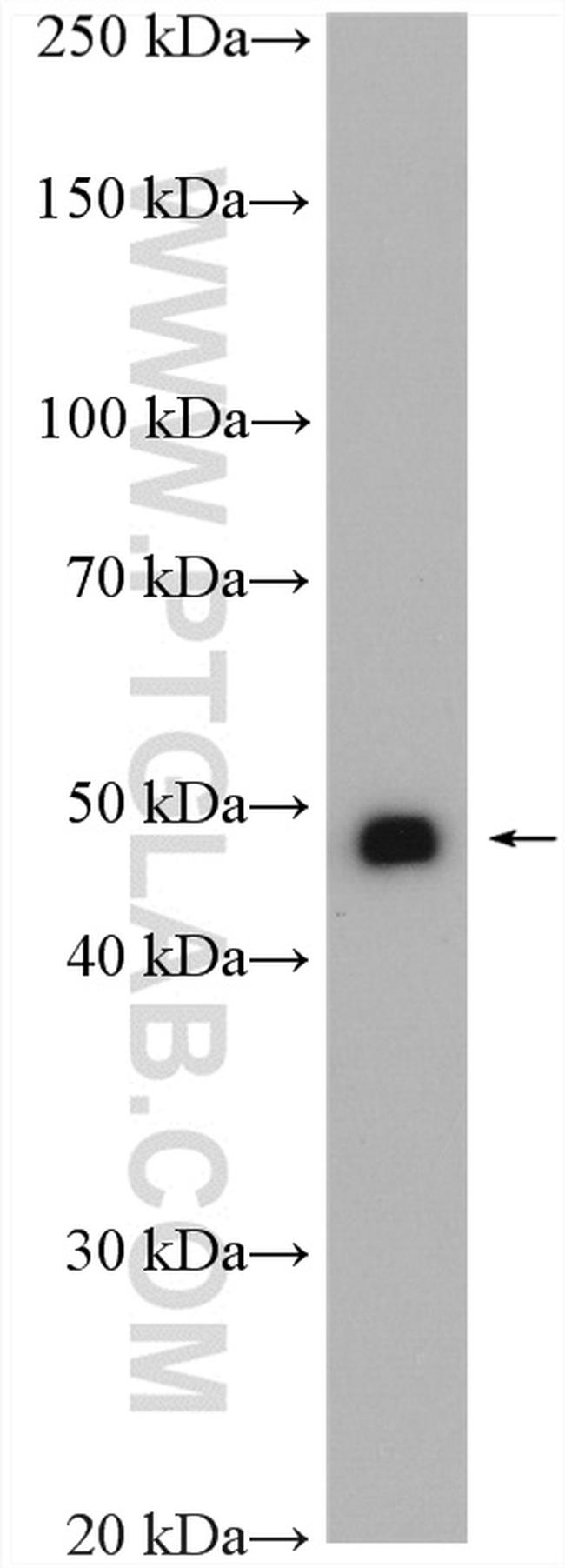 NKX6-1 Antibody in Western Blot (WB)