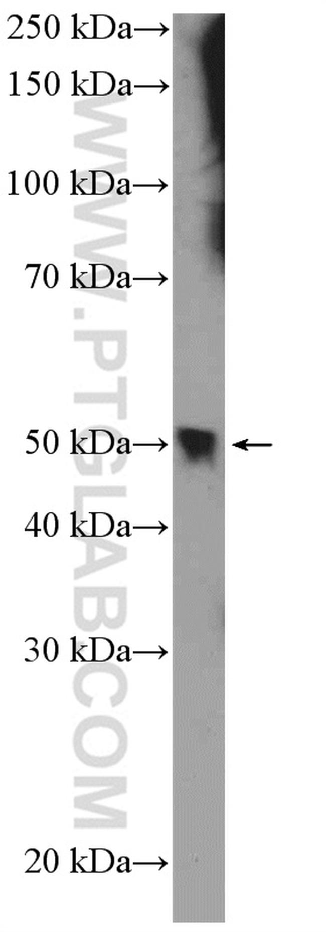 HB9 Antibody in Western Blot (WB)
