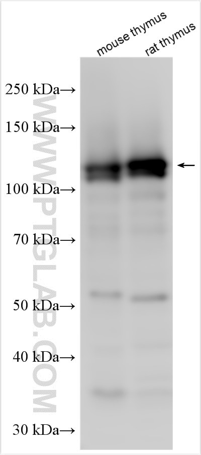 RAG1 Antibody in Western Blot (WB)