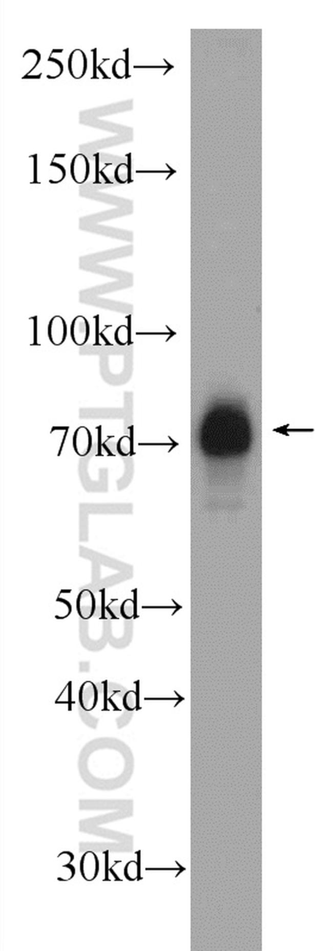 NR2C2 Antibody in Western Blot (WB)
