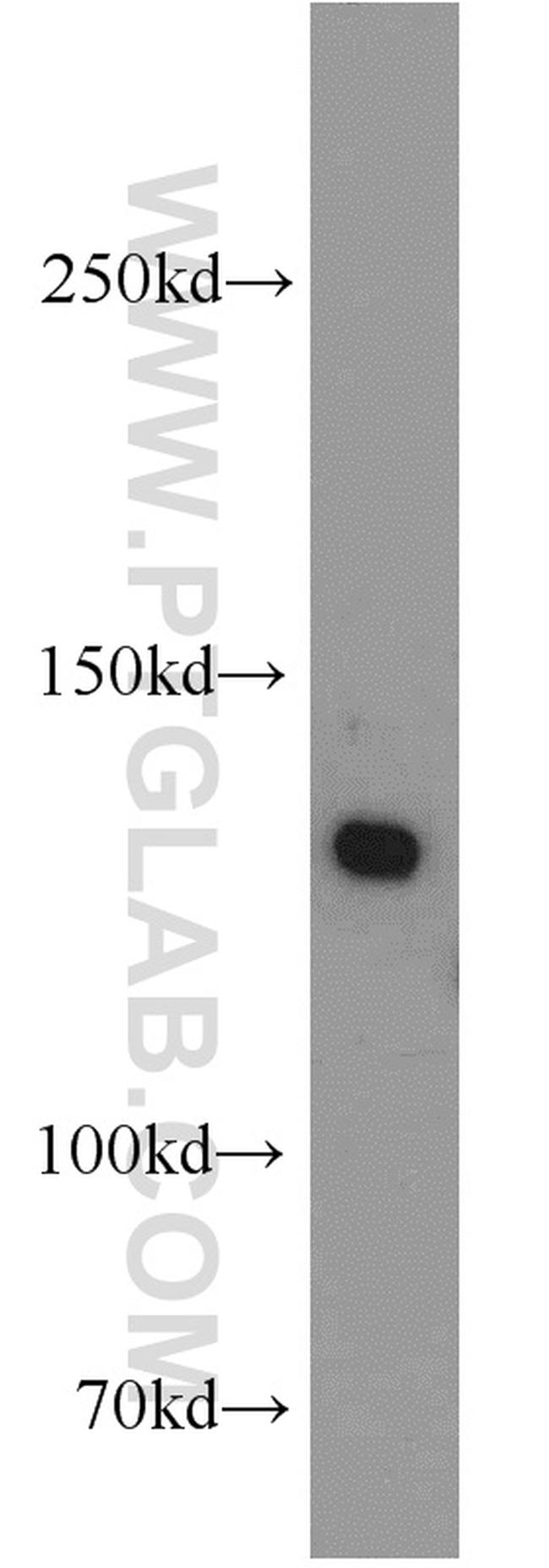 BRIP1 Antibody in Western Blot (WB)
