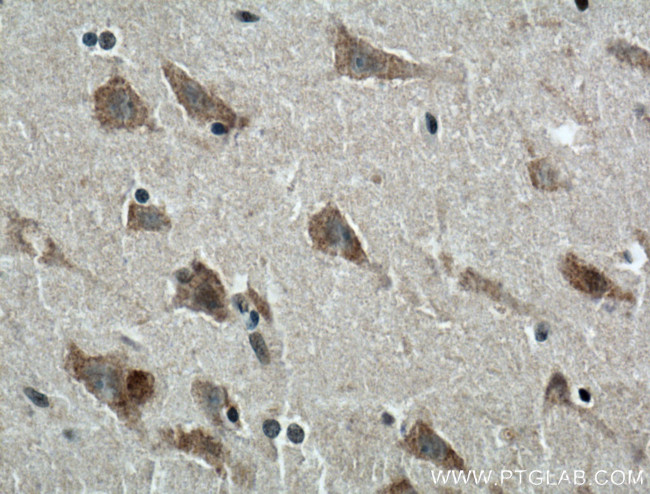 TRPV4 Antibody in Immunohistochemistry (Paraffin) (IHC (P))