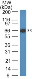 Estrogen Receptor (Marker of Estrogen Dependence) Antibody in Western Blot (WB)