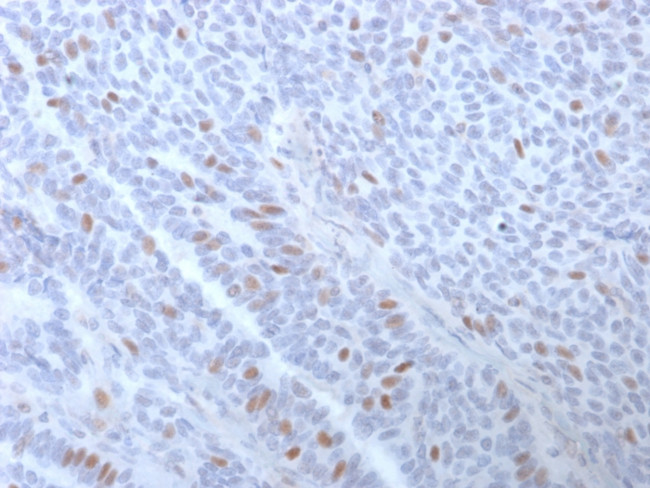 Estrogen Receptor, alpha (Marker of Estrogen Dependence) Antibody in Immunohistochemistry (Paraffin) (IHC (P))