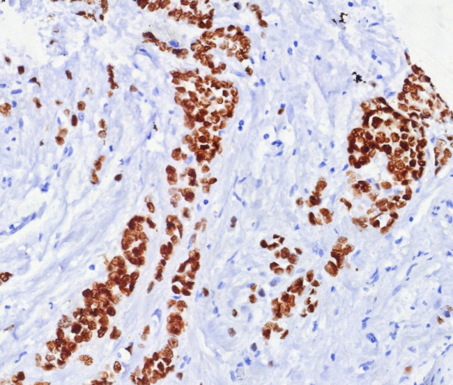 Estrogen Receptor, alpha (Marker of Estrogen Dependence) Antibody in Immunohistochemistry (Paraffin) (IHC (P))