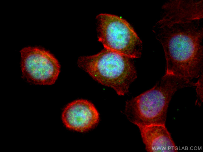 Cyclin T1 Antibody in Immunocytochemistry (ICC/IF)