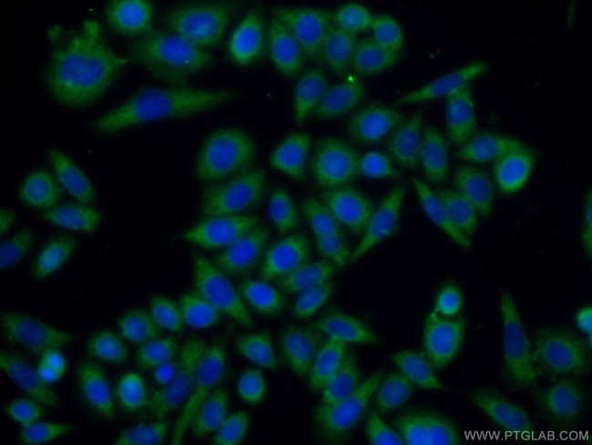 TMEM106B Antibody in Immunocytochemistry (ICC/IF)