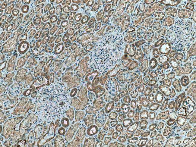 TMEM61 Antibody in Immunohistochemistry (Paraffin) (IHC (P))
