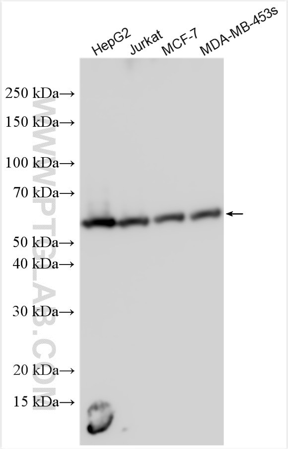 JMJD5 Antibody in Western Blot (WB)
