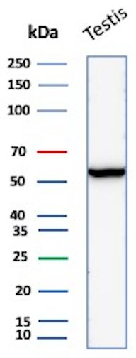 ER-beta (Estrogen Receptor beta-2) Antibody in Western Blot (WB)